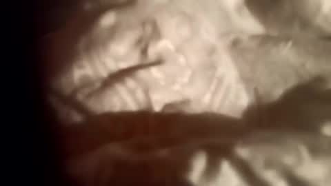 Snapshot of moos1 chatting on 28, 2, 2026 moos1 online show from 28, 2, 2026